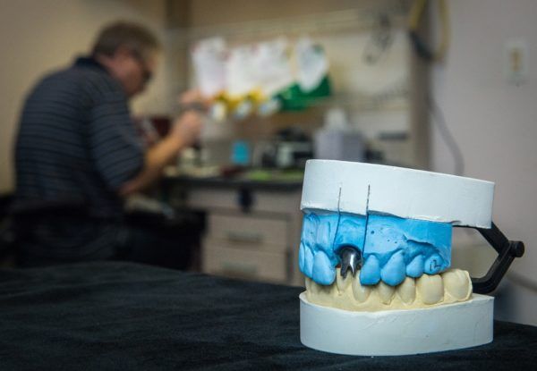 Dental models on the lab bench